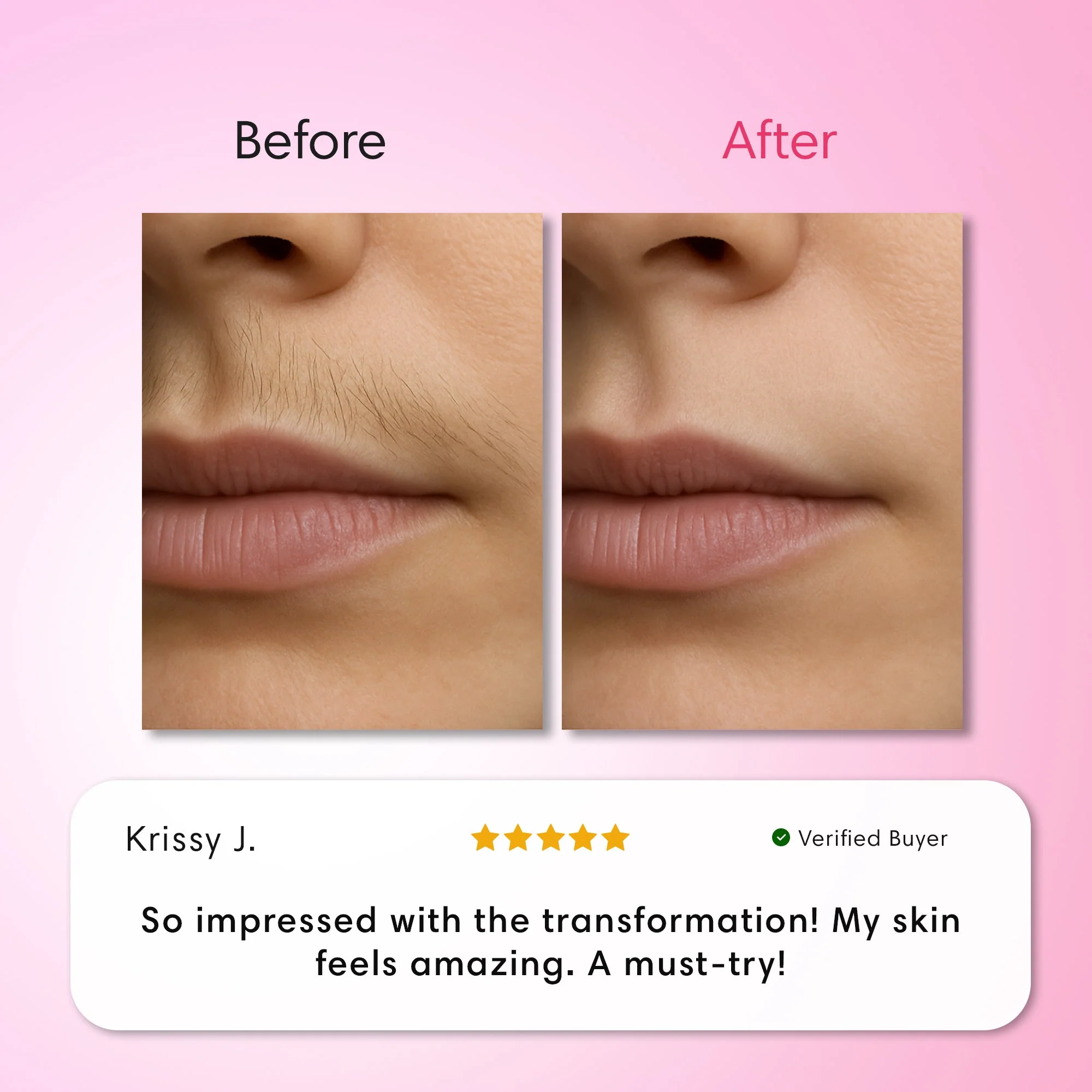 Hair Removal Trilogy Kit - Image 8