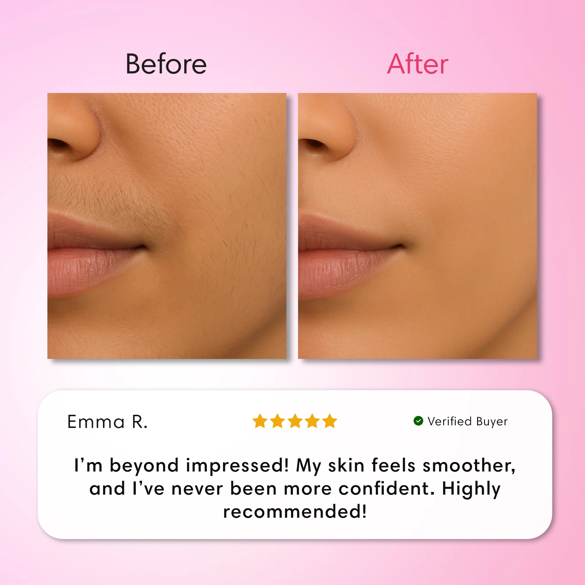 Hair Removal Trilogy Kit - Image 10