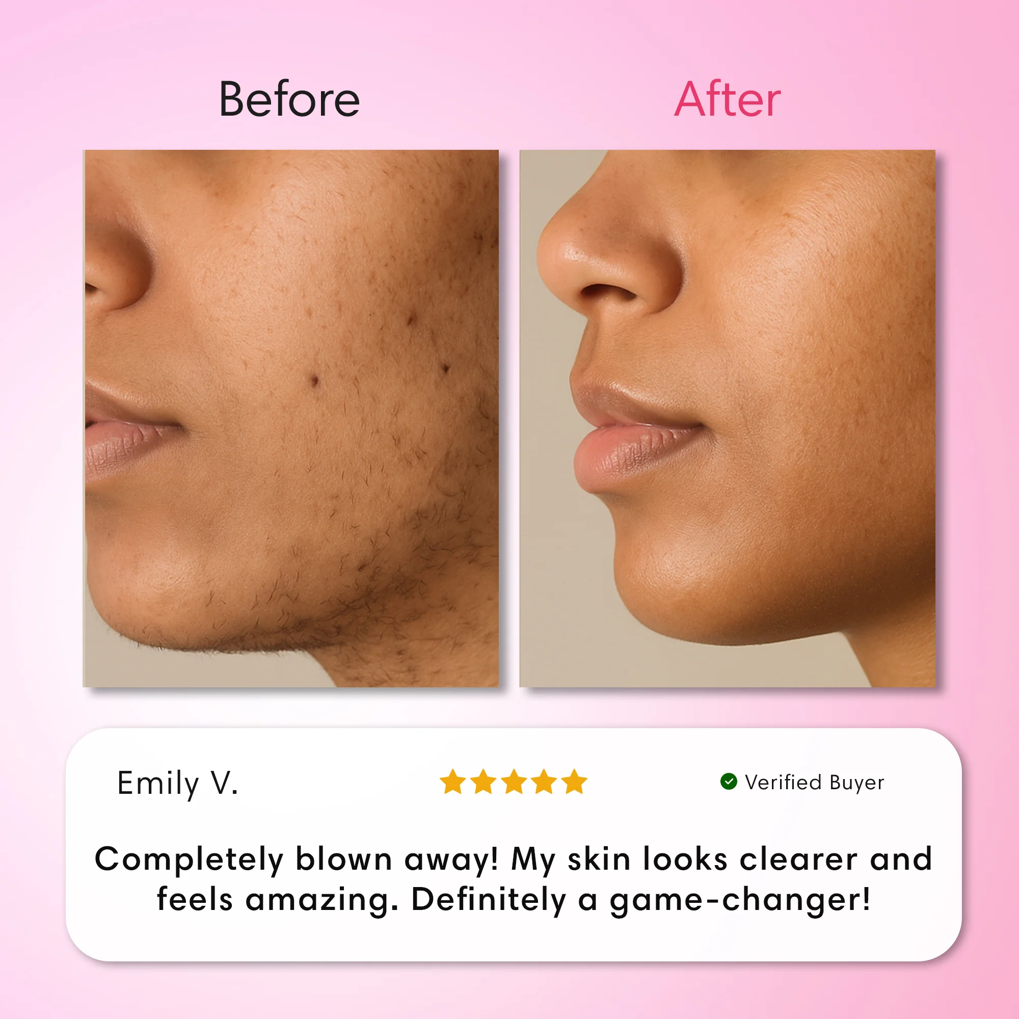 Hair Removal Trilogy Kit - Image 2