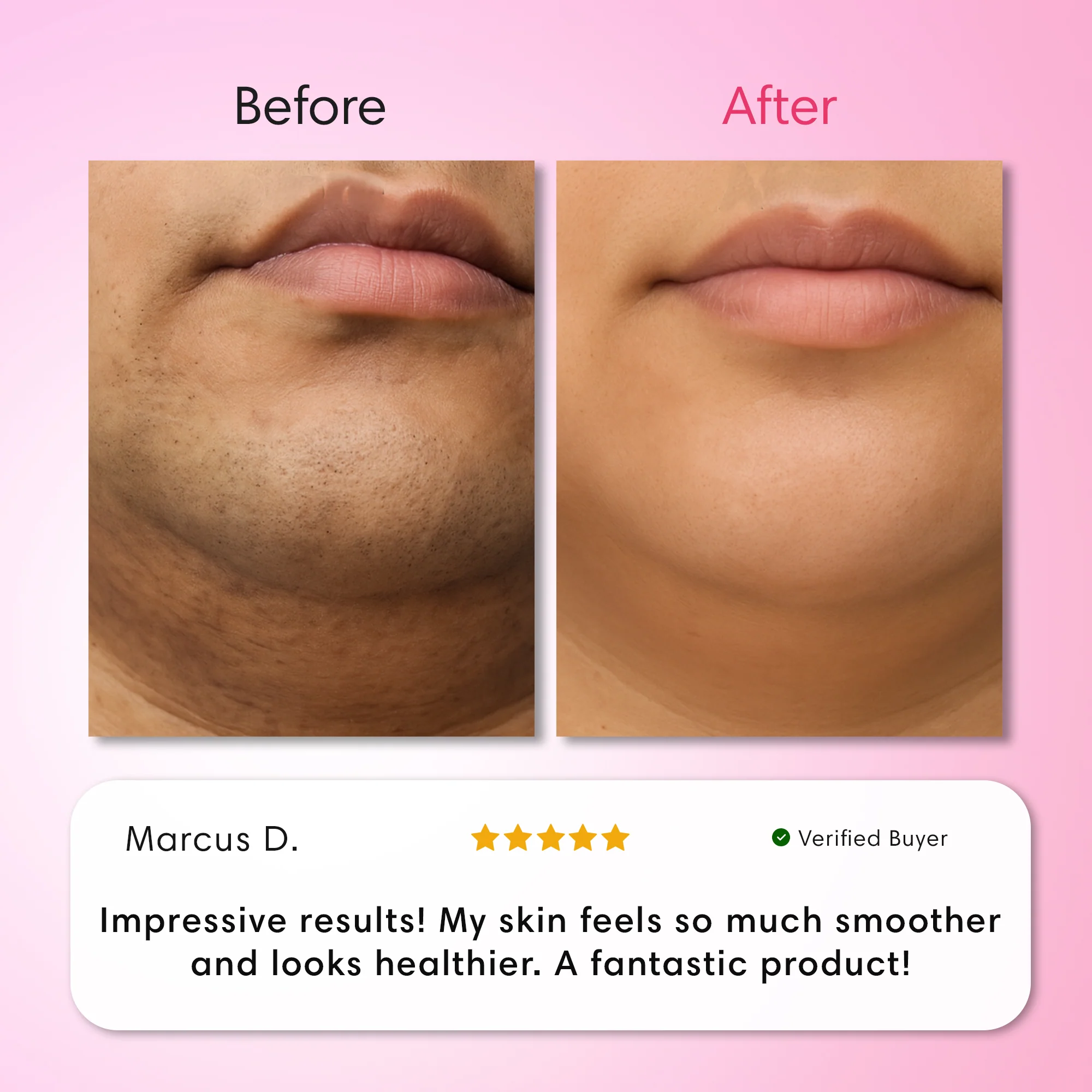 Hair Removal Trilogy Kit - Image 7